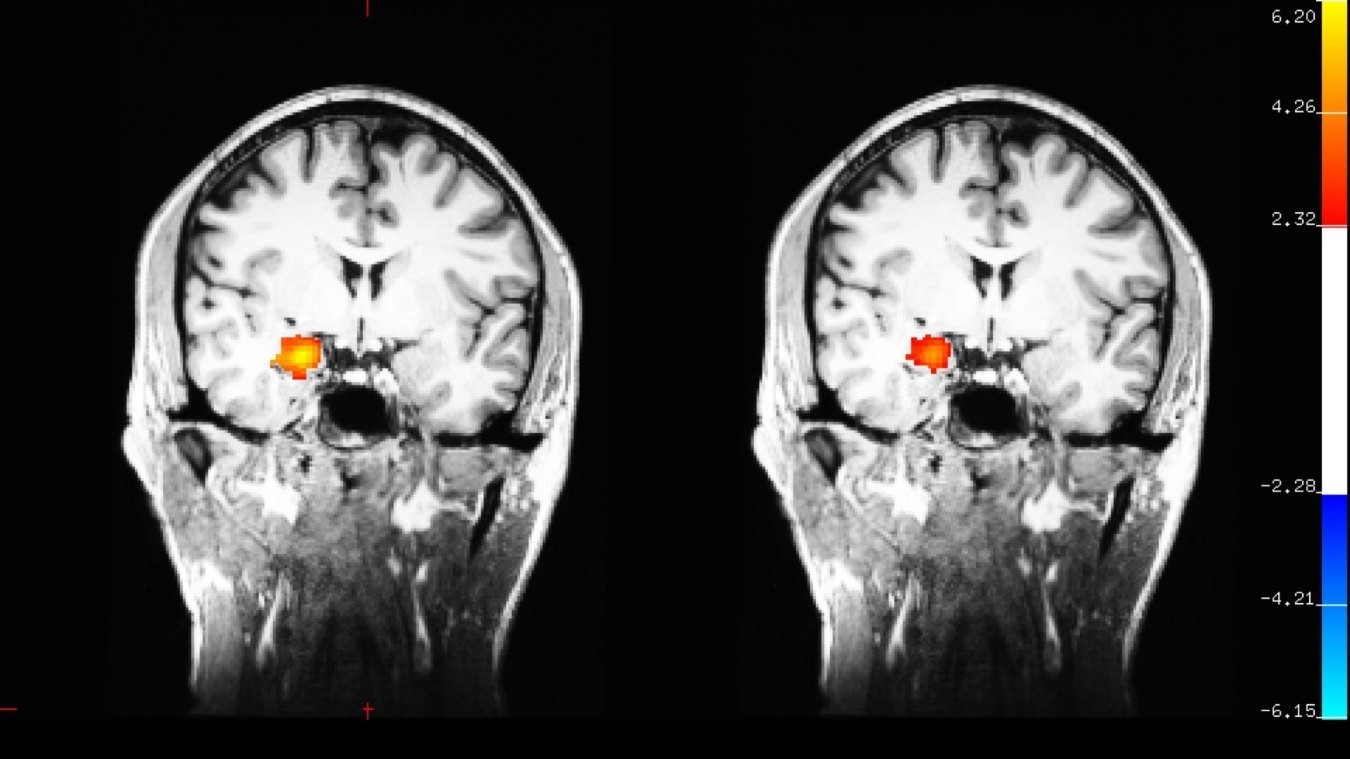 BrainScanImage